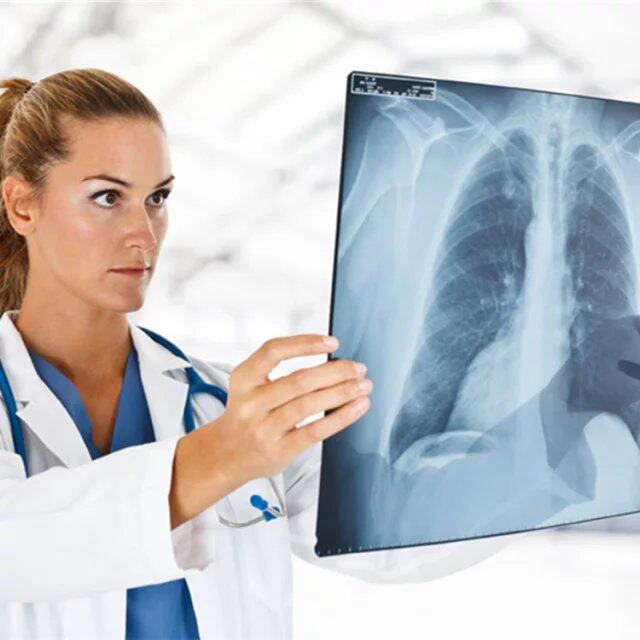 New medical inkjet blue-based HD printing negatives DR CR CT X-ray magnetic resonance blue inkjet negatives