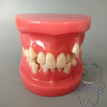 Dental Oral Orthodontic Malocclusion Display Model Teaching Model Dental Students Practice Doctor-Patient Communication with Brackets