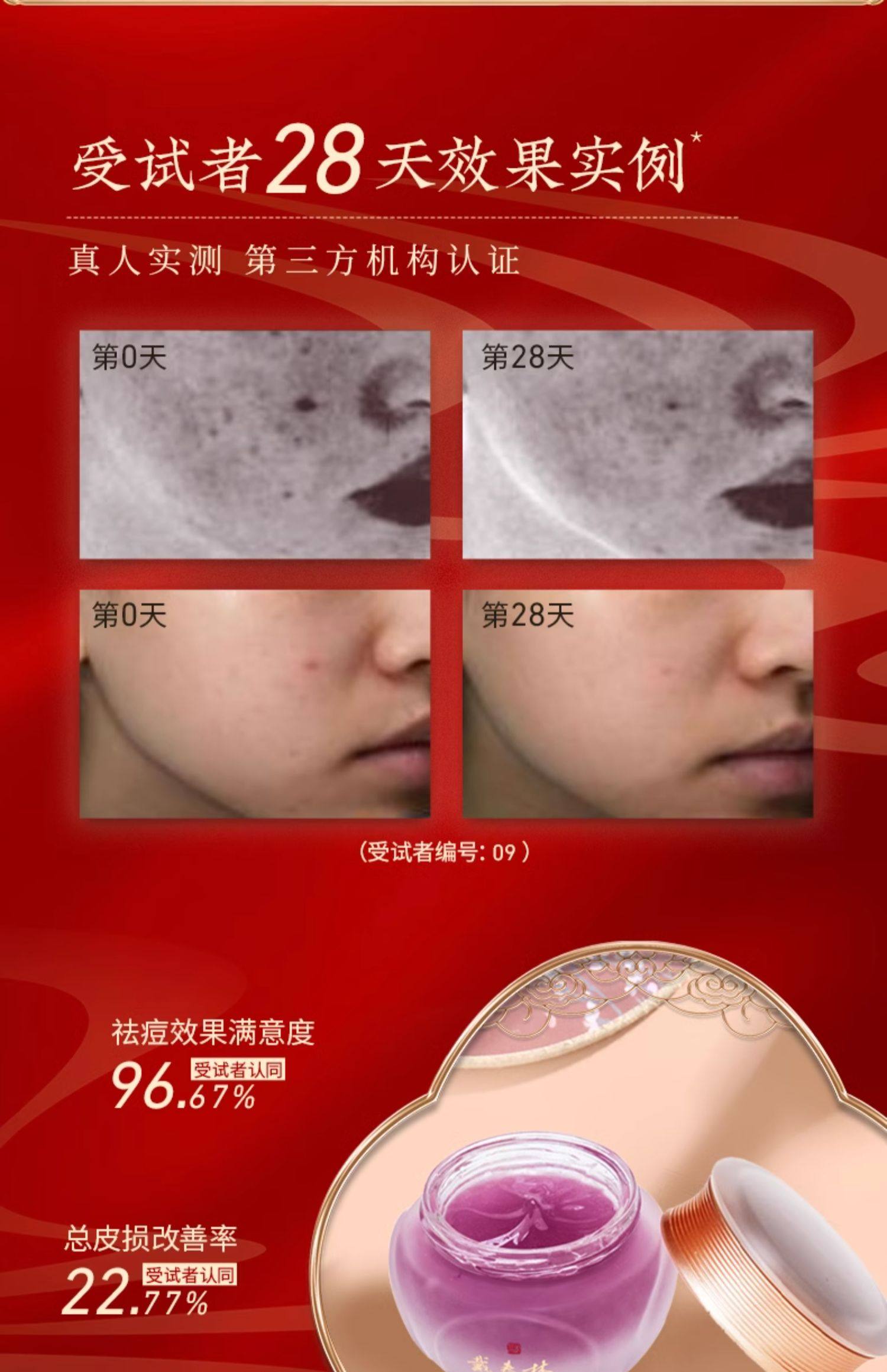 【中國直郵】戴春林紫玉膏祛痘保濕面膜保養品乳霜清爽凝露面膜50g/瓶