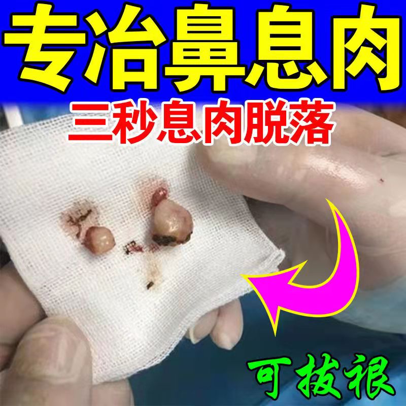 Allergic Rhinitis Special Effects Radical Nasal Chia Hypertrophy News of Meat Repair God Instrumental Child Sinusitis Special Medicine