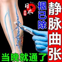 Varicocele tumor sock vein leshu cold gel special patch ointment calf external therapeutic device Medical