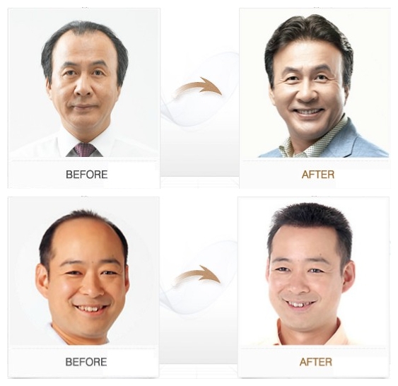 Extension cheveux - Ref 216851 Image 15