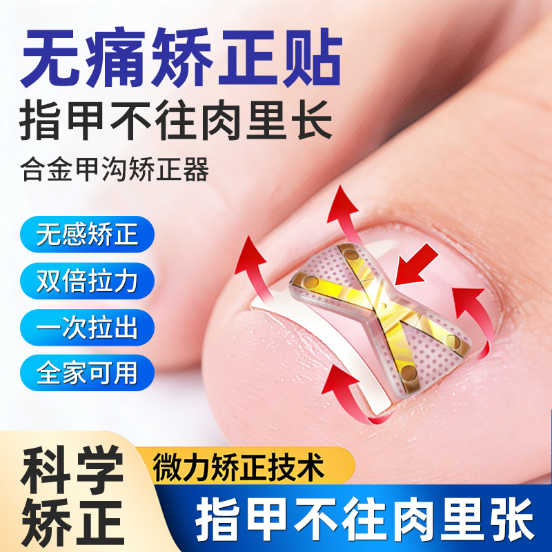 Nail Groove Inflammation Nail Corrector Patch, Special Nail Correction Patch for Toenails That Grow into the Flesh