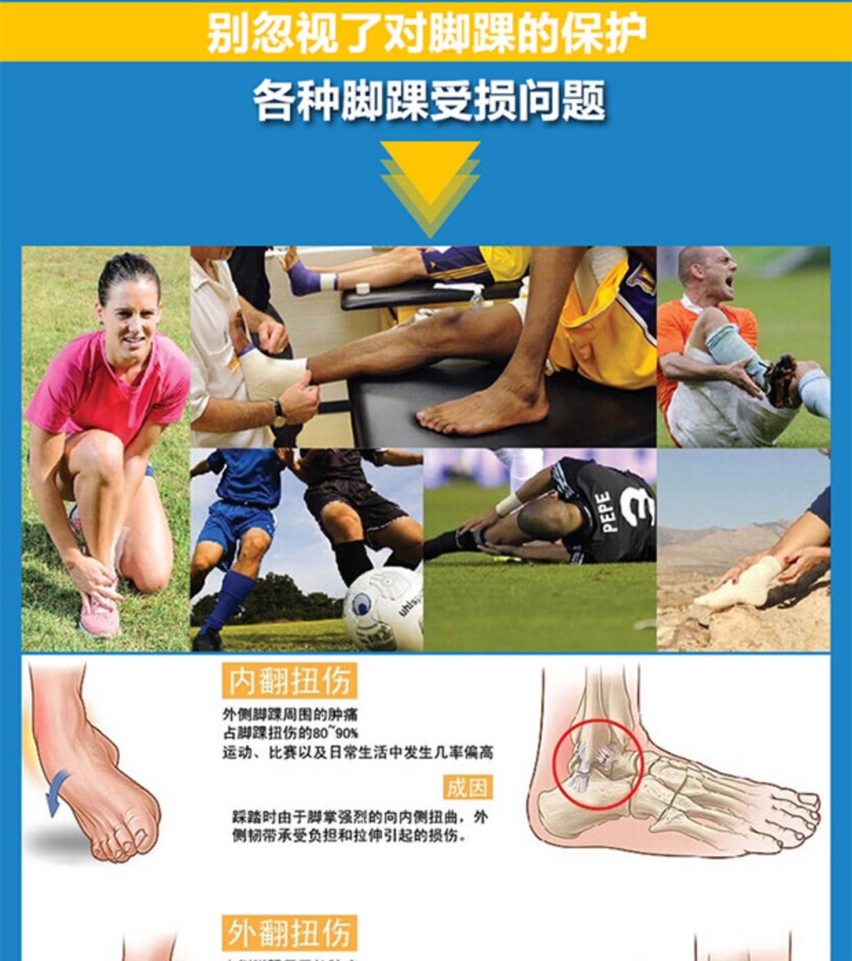 Chính hãng JCSP bong gân bảo vệ mắt cá chân bóng rổ bóng đá mắt cá chân thể thao băng bảo vệ mắt cá chân băng cố định đầu gối