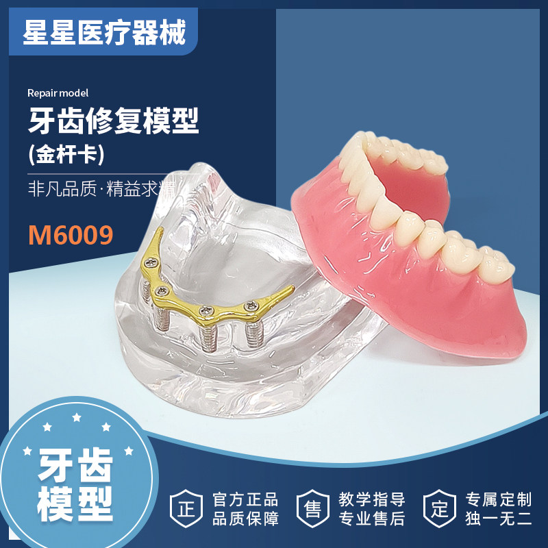 牙科口腔模型金杆卡种植仿真模型牙齿修复的演示仿真模拟教学讲解