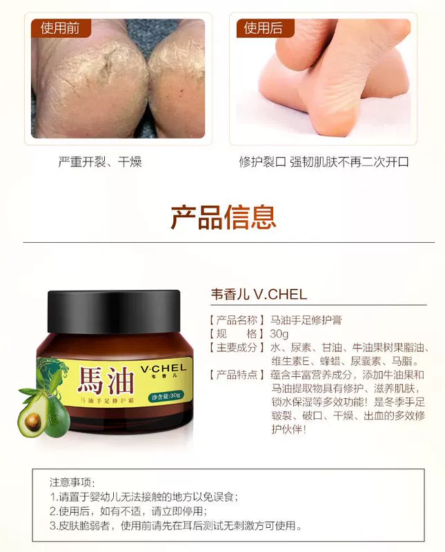 Wei Xianger Ma Ointment Cleavage Cream Tay và chân Cracking Kem chống nứt Kem dưỡng ẩm Kem dưỡng da tay và chân Crack 50g mặt nạ lột da chân