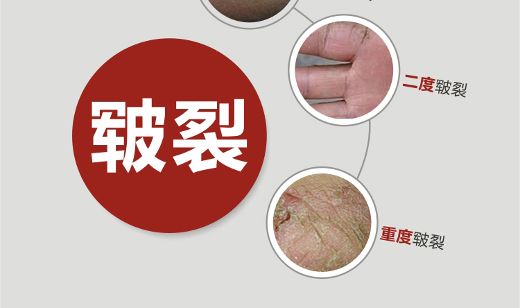 Tay và chân kem sửa chữa kem tay dịu dàng kem chân chân giữ ẩm dưỡng ẩm chống khô tay và chăm sóc bàn chân mặt nạ ủ chân