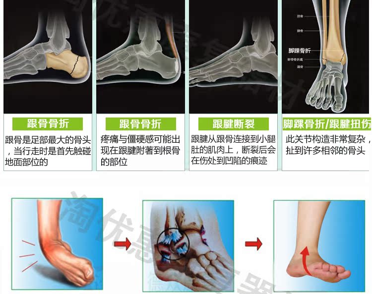 脚后跟骨折跟腱断裂我父亲后脚跟跟腱断裂 当地医生建议取自 脚后跟骨折跟腱断裂我父亲后脚跟跟腱断裂 当地医生建议取自