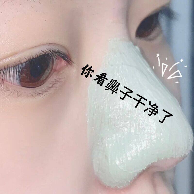 (Little Red Book is super hot) Don't squeeze, let me discharge the dirty things~ Clean the pores, replenish water and control oil on the face