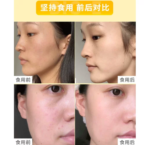 Взятие 2/3 неожиданной цены Австралия био-е-е-золотой лимонный карманный фермент желе желе оригинальная жидкость 30 мл*14 пакетов с портативными