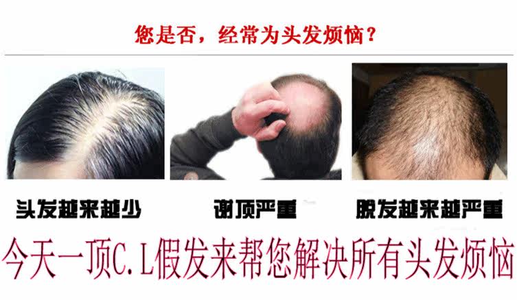 Extension mèches - Ref 216764 Image 7