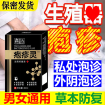 Genital herpes virus eradication mens and womens blisters itching ulcers HSV zonal sequelae and prevention of recurrence.