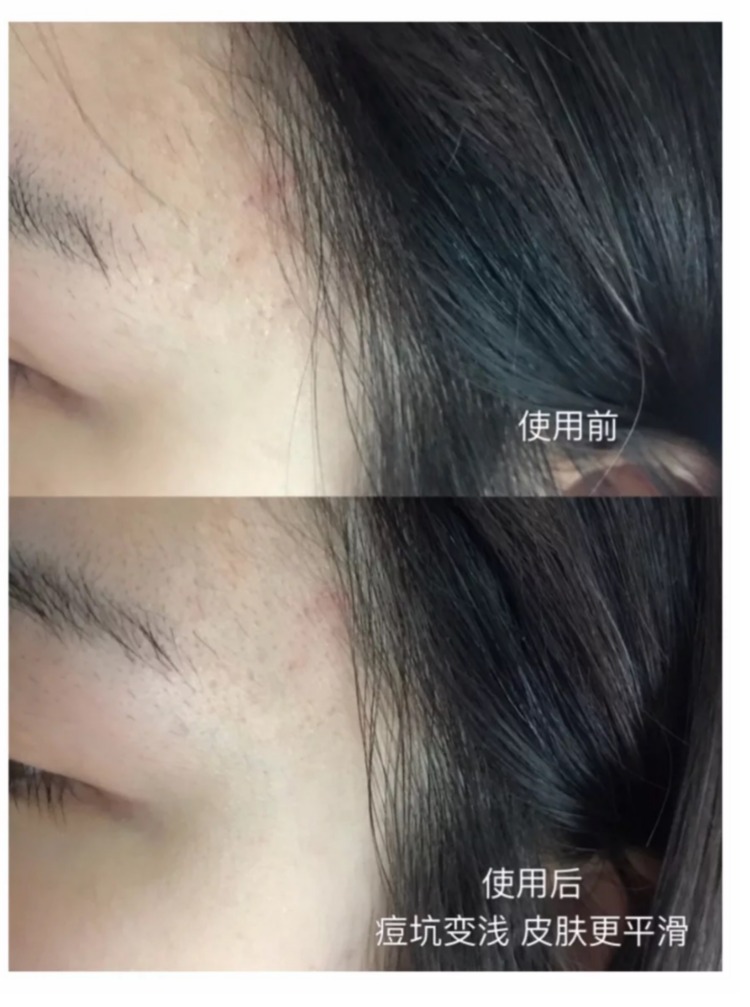 Spot Murad triple cách ly vô hình spf30 +++ trang điểm bảo vệ trước khi cách ly sữa Zhang Kaiyi khuyến cáo che khuyết điểm kryolan