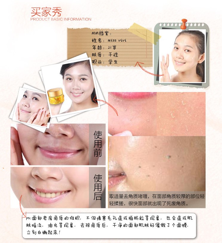 Shimei Jiali Rose Gel tẩy tế bào chết 1000g Nam và nữ Body Facial Exfoliating Gel Cleansing Scrub tẩy da chết cho nam