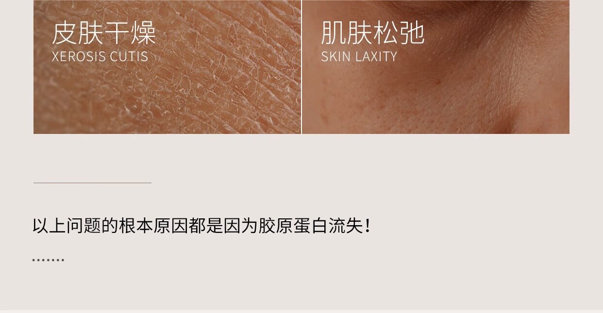 【中國直郵】EKET 醫用重組人源Ⅲ型膠原蛋白皮膚修補護理膜 淡法令紋神器 【小紅書強烈推薦】