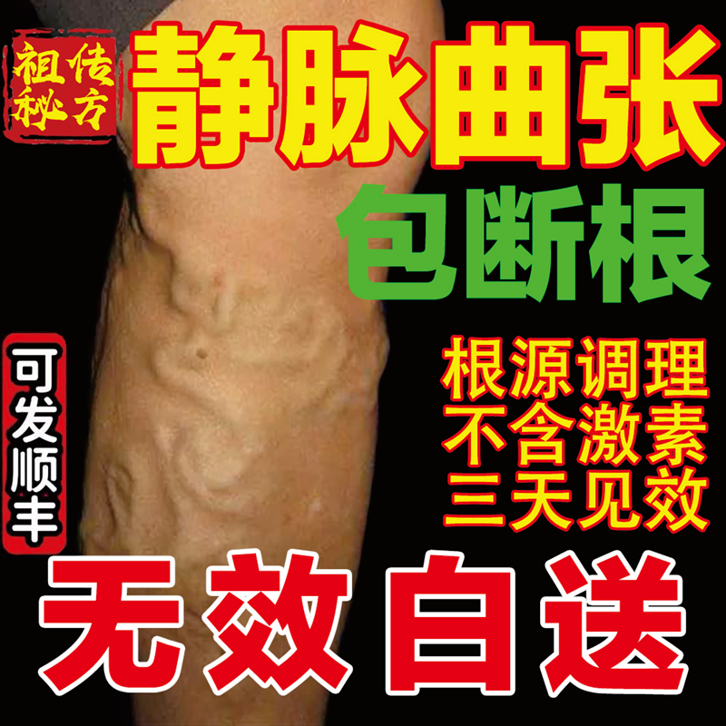 Authentic Cold Compress Gel for Varicose Veins, Swelling of Leg Blood Vessels, and Special External Use for Treating Varicose Veins, Authentic Special-Effect Chinese Medicinal Ointment Authentic Cold Compress Gel for Varicose Veins, Swelling of Leg Blood Vessels, and Special External Use for Treating Varicose Veins, Authentic Special-Effect Chinese Medicinal Ointment