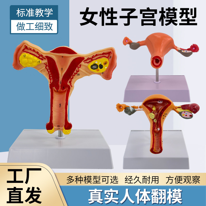 教学子宫卵巢病理变化解剖模型 女性内生殖解剖模型 妇科培训教具