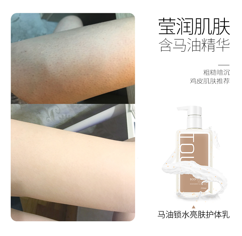 Sữa dưỡng thể dưỡng ẩm cho cơ thể dưỡng ẩm cho da gà Kem dưỡng da Kem dưỡng da toàn thân chăm sóc nam nữ lăn khử mùi etiaxil