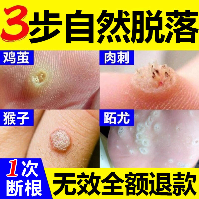 🌿揭秘!根梦解析正版《心理类书籍跖疣特效药刺猴专用药膏》——祛除肉粒疙瘩的神奇武器🛡️-宠物报纸-淘宝好物网
