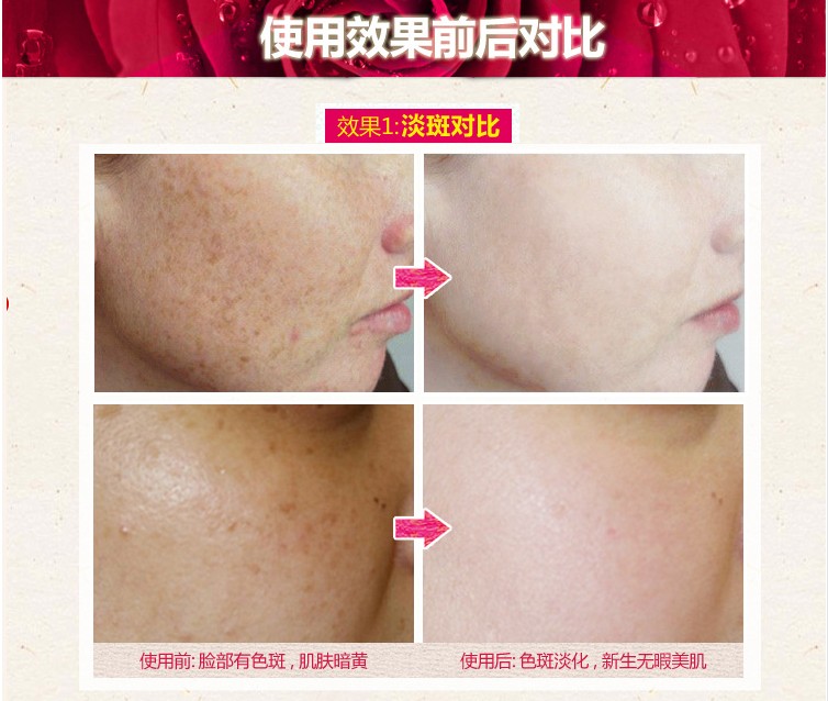 [Mua hai tặng một] Tinh dầu hoa hồng Tango 10ML tinh dầu hoa hồng oải hương chanh trắng - Tinh dầu điều trị tinh dầu dễ ngủ