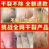 Foot splitting paste Turtle Cracked Cream of Cracked Cream Hand Foot Peeling Cracking Mouth Horse Oil Cream Anti-Dry Cleft Heel Dry Cracking Repair Cream