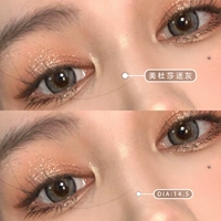 14.5mm