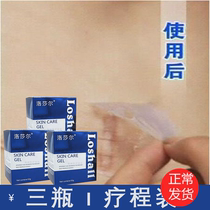 Losars official website injury scar cream pimple paste light melanin cesarean section bulge surgery to proliferate acne marks