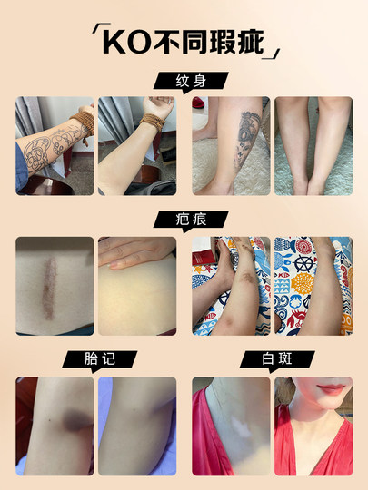 Tattoo cover scar patch concealer invisible flesh-colored artifact makeup artist special mole depression convex summer waterproof