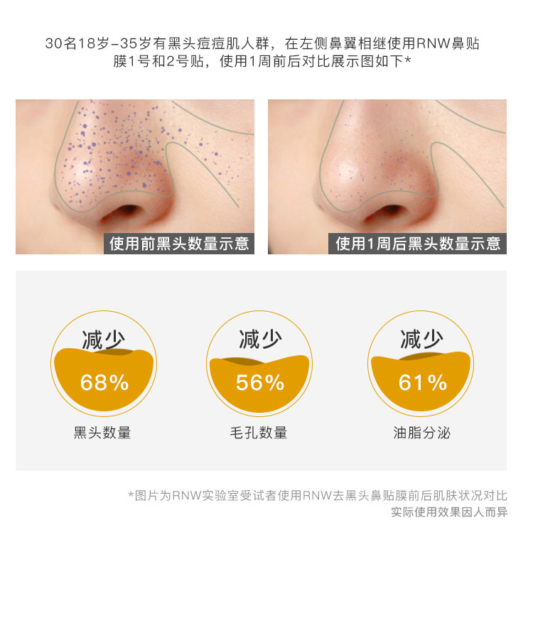 Rnw mũi dính mụn đầu đen làm sạch lỗ chân lông thu nhỏ hướng dẫn chất lỏng mút dâu mũi chính hãng nam và nữ Hàn Quốc mặt nạ đất sét cho da dầu mụn