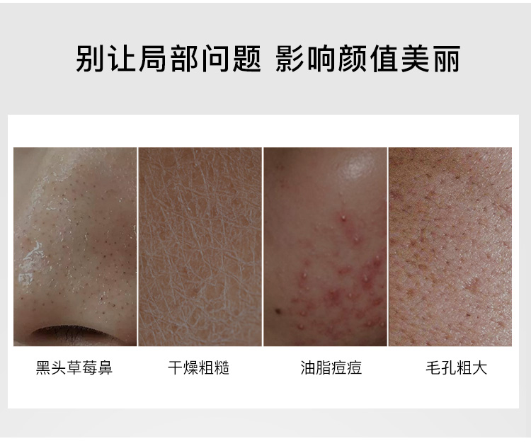 Phim cotton axit salicylic rnw để đóng mụn mụn in mụn đầu đen brocker làm sạch phụ nữ co lại lỗ chân lông chính thức mặt nạ giấy cho da dầu
