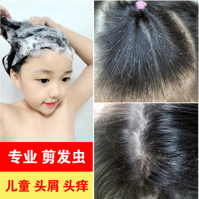 Hair cutworm shampoo for girls professionally go curlew eating hairworm anti-mite special anti-dandruff anti-itch shampoo for children