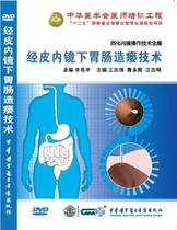 Percutaneous endoscopic gastrointestinal ostomy DVD Digestive Endoscopic Manipulation Technique Percutaneous Endoscopic Gastroenterostomy Techniques