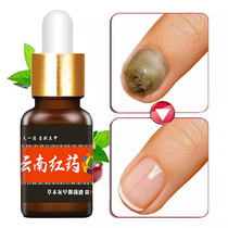 Gray toenail special liquid (can be spent) (not good white send)Set of special drugs quality authority