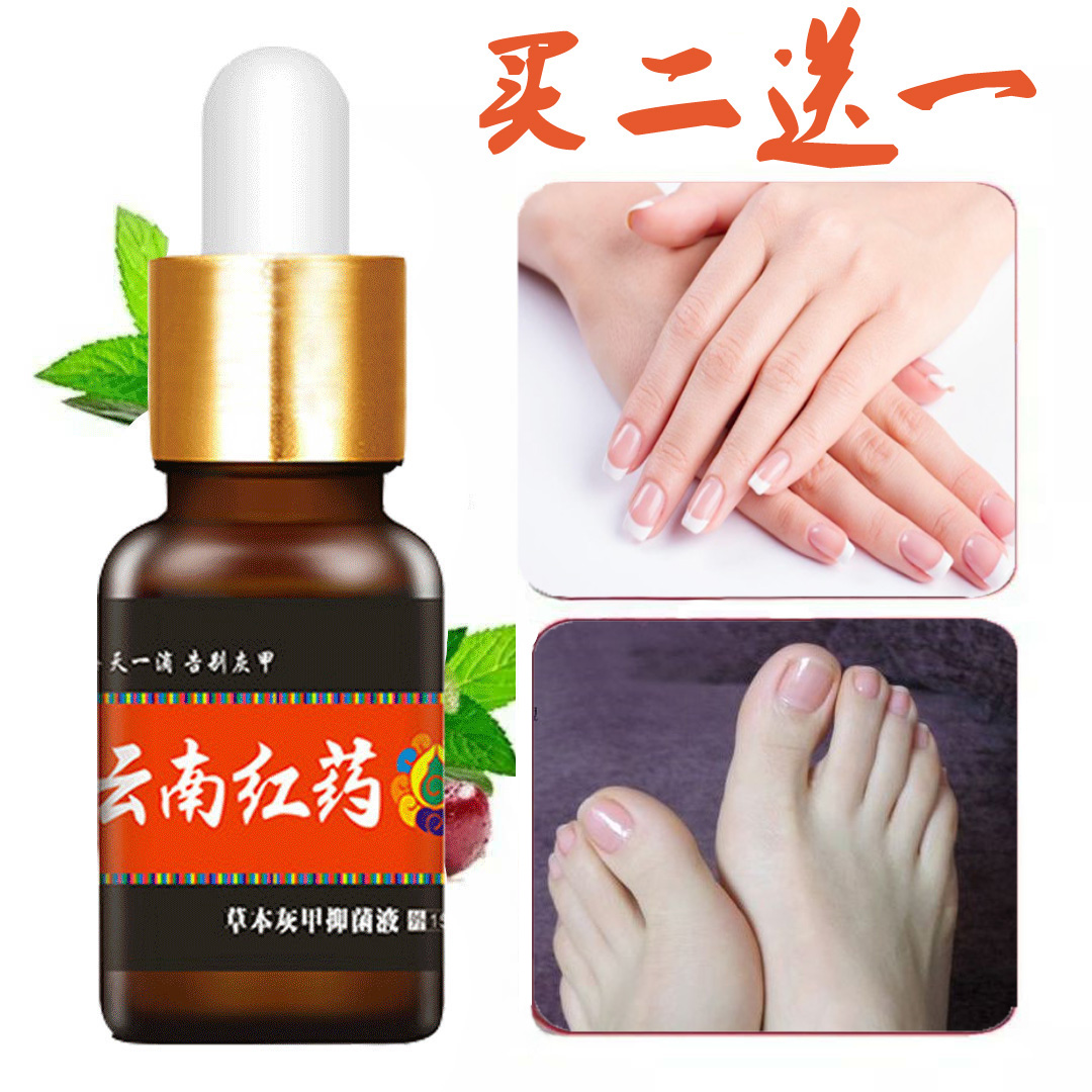 Live referral recommended gray toenails special liquid (bad white send) to buy two-deliver one) suit special medicine quality authority