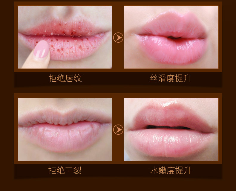 爱 Tẩy tế bào chết tẩy tế bào chết Lip Lip Môi dưỡng ẩm giữ ẩm cho môi dưỡng môi trị thâm