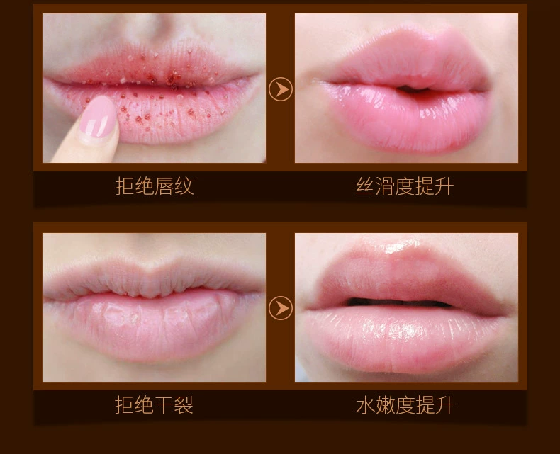 爱 Tẩy tế bào chết tẩy tế bào chết Lip Lip Môi dưỡng ẩm giữ ẩm cho môi