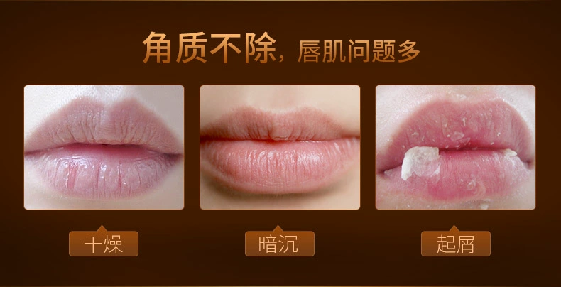 爱 Tẩy tế bào chết tẩy tế bào chết Lip Lip Môi dưỡng ẩm giữ ẩm cho môi