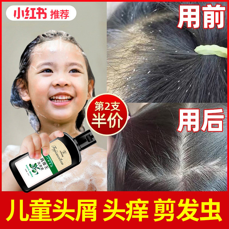 Children shampoo special girls go to scraps to cut and cut hair bugs 6 years old 3-15 year old official brand