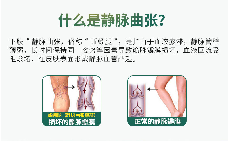 Mỹ VH giãn tĩnh mạch sản phẩm cải thiện chi dưới tinh trùng đau lưu thông máu ít vận động đứng lâu 60 viên - Thức ăn bổ sung dinh dưỡng thực phẩm chức năng tăng chiều cao