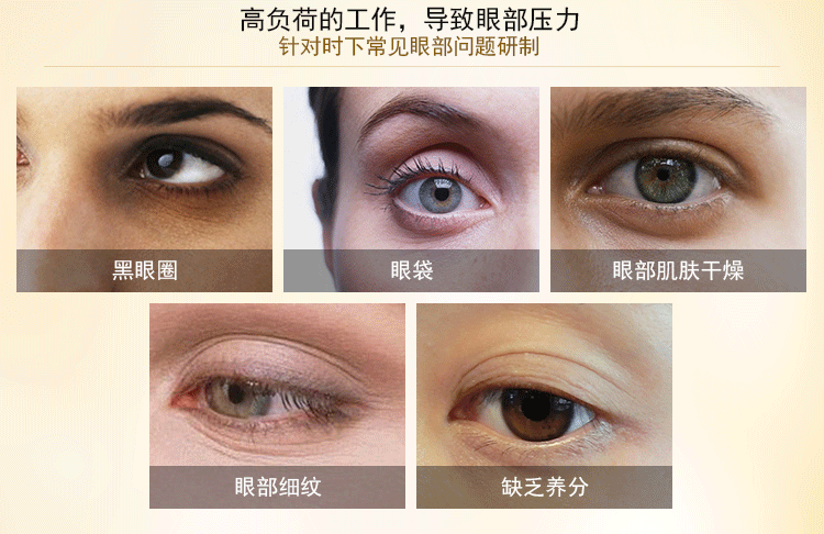 Beauty salon chăm sóc mắt kit Effie chăm sóc mắt kem dầu phai quầng thâm mắt bộ kem dưỡng da mắt