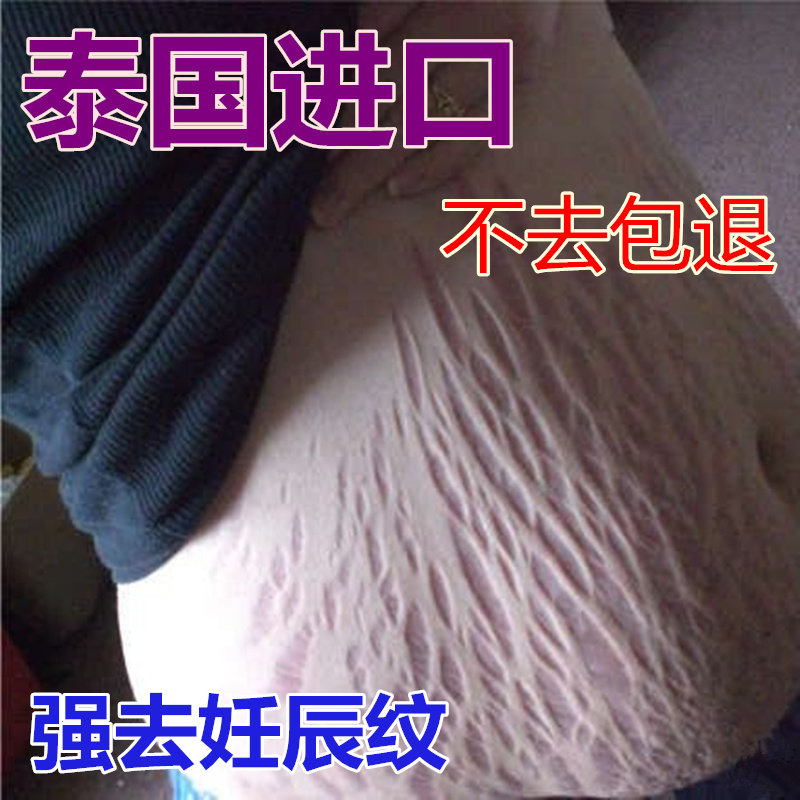 泰国强效去妊娠纹产后消除祛肥胖纹孕妇预防生长祛除妊辰纹修复霜