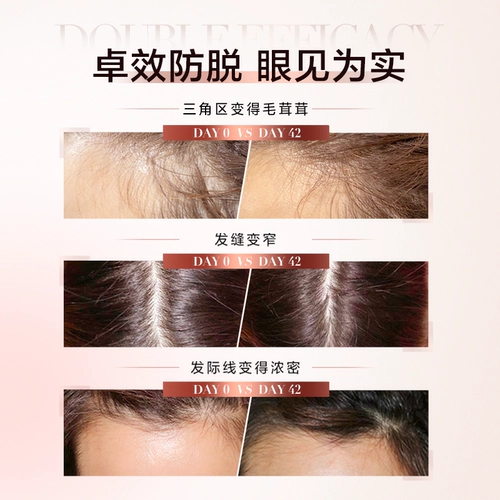 L'Oreal, эссенция, водный пистолет, освежающий спрей для кожи головы, 38