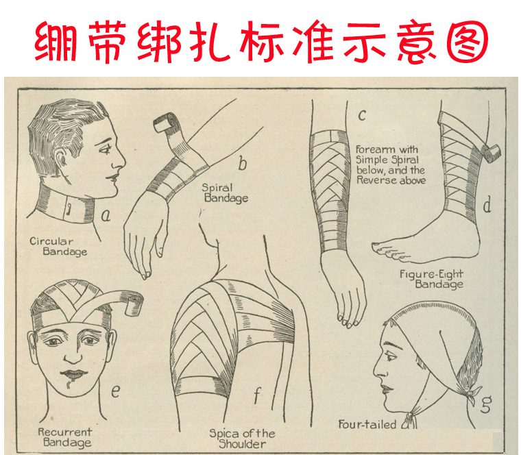 Protection sport - Ref 584917 Image 13