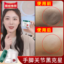 Elbow to black to remove dead skin joint melanin artifact elbow knee fingers black exfoliant whitening ankle
