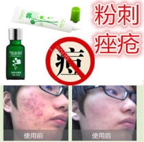 Product: Acne removal on chest wine pimples pimples removal acne removal fat pimple removal on back smoothing of pimples