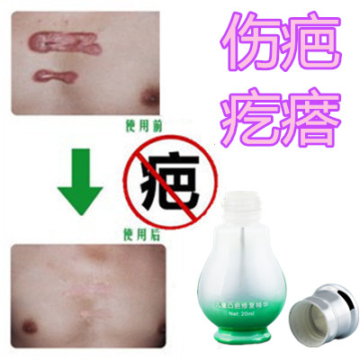 In addition to removing stitches, surgery scar marks chilblain bruises repair cesarean section convex scar pimples smoke scar fall medicine