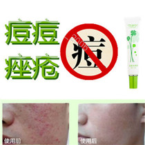 Repair miracle herbal product to remove back acne scars remove acne scars acne acne and flatten blackheads