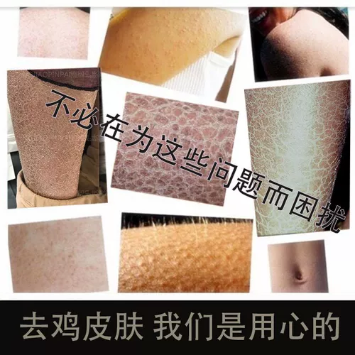 Мао Чжоу кератинизированный мази для сливочного кремового кремового крема для кожи на кожи на коже волосыва