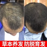 博倩 Лосьон для волос по линии роста волос, сыворотка для кожи головы, питательный раствор подходит для мужчин и женщин