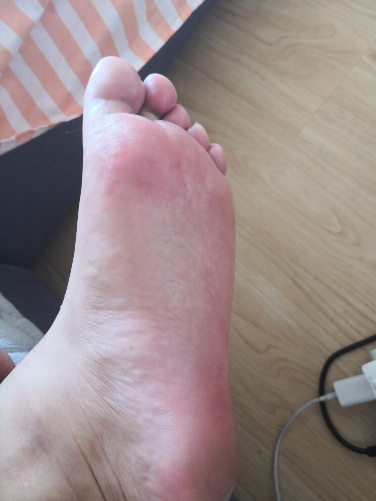 泰利三佳银离子除脚臭好不好用，买来做礼物送人合适吗_搜券